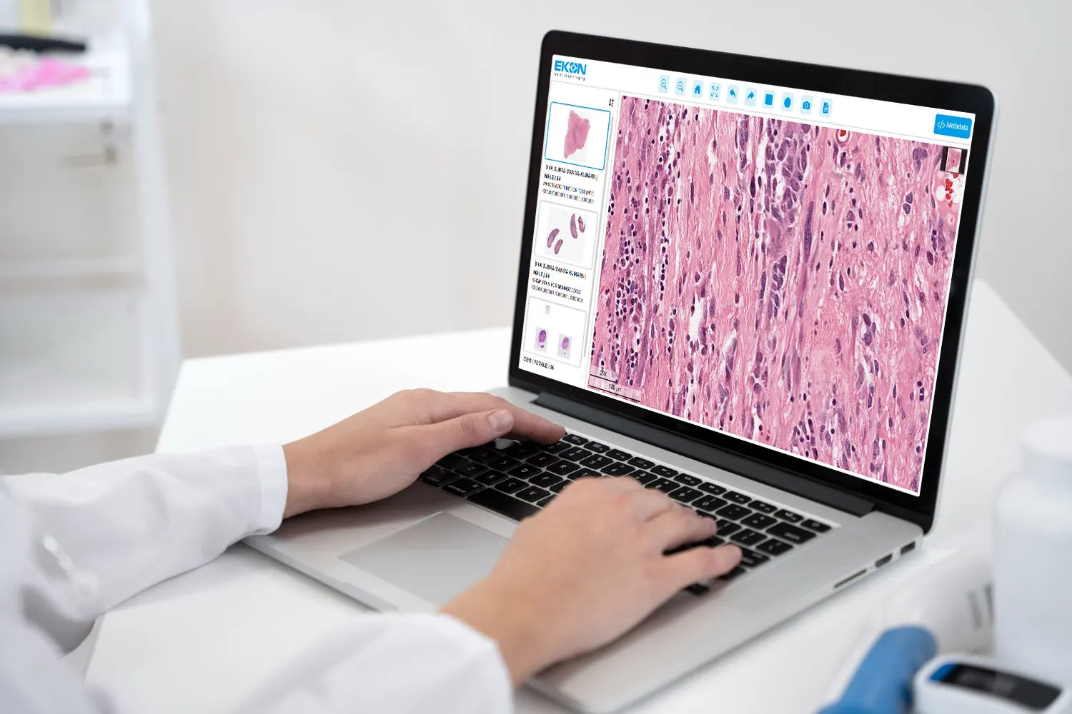 Displaying  microscopic image at 40x  of tissue sample with pink and purple hues